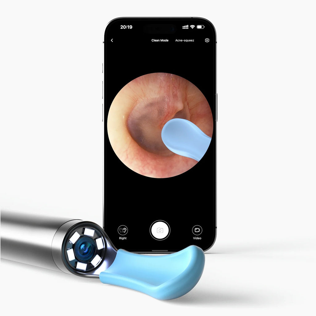 Smart Visual Ear Wax Removal Tool with HD Camera – Safe USB Ear Cleaner for Easy Ear Canal Cleaning