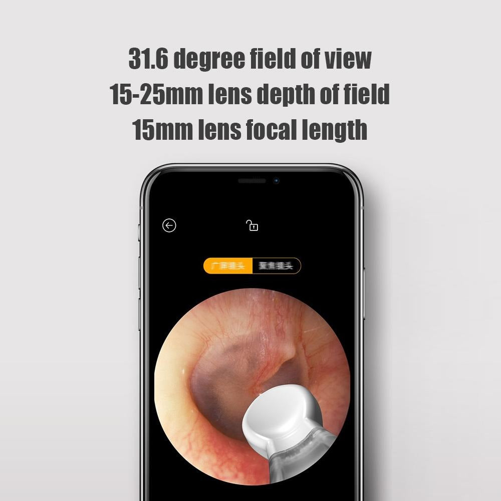 Smart Visual Ear Wax Removal Tool with HD Camera – Safe USB Ear Cleaner for Easy Ear Canal Cleaning